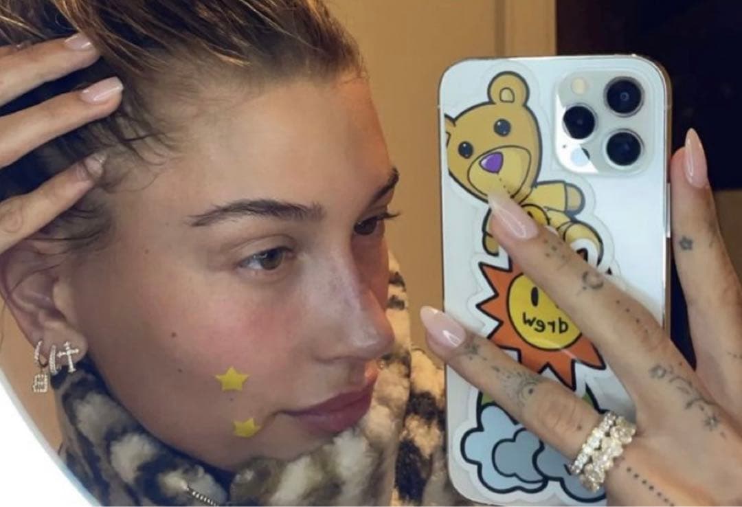 ああ　限定品　star face ハローキティ　ニキビパッチ　ケース付き