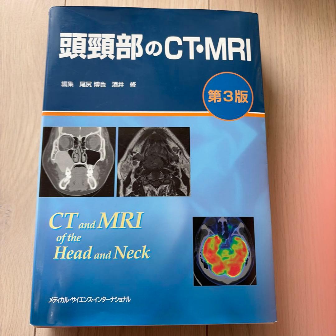 【裁断済み】頭頸部のCT・MRI