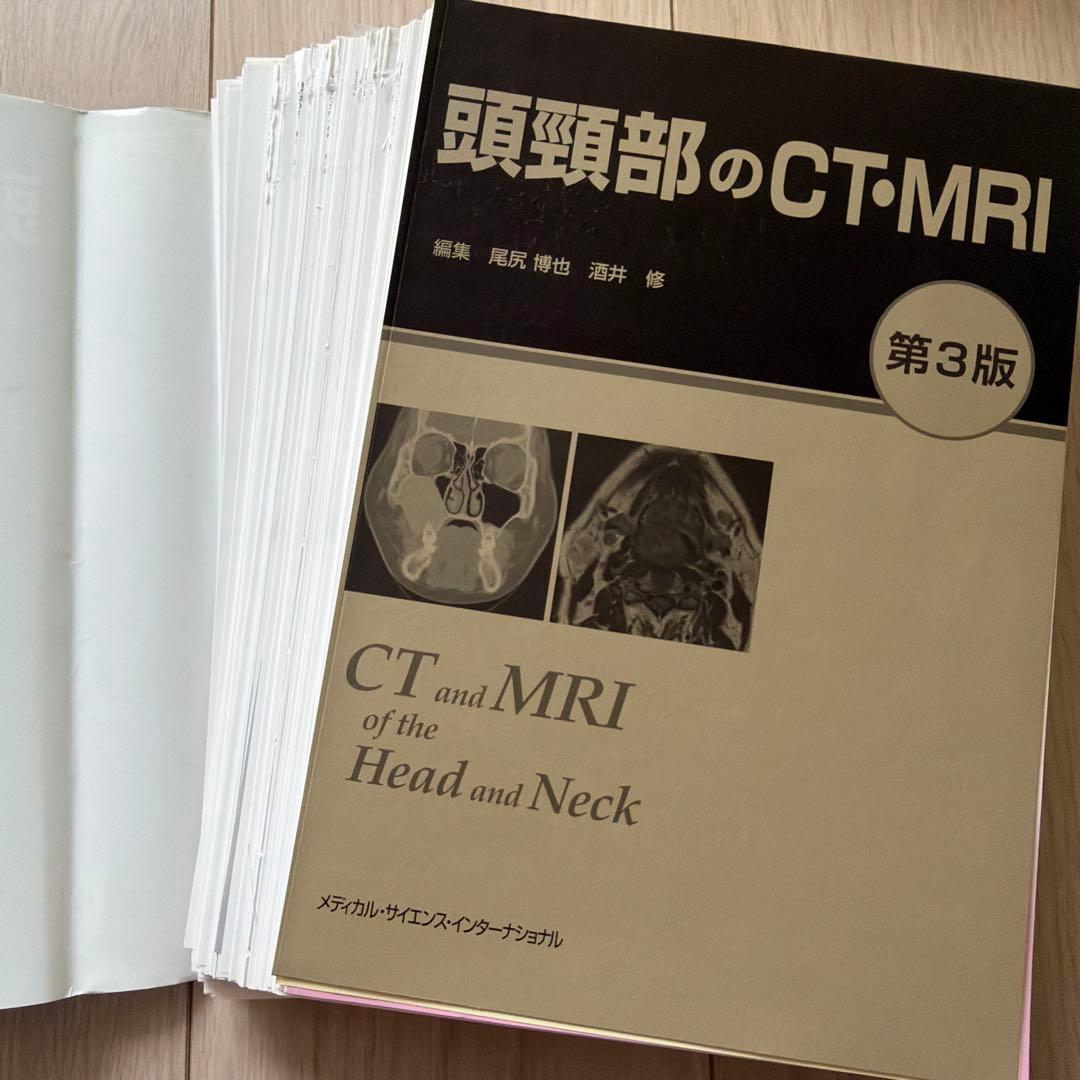 【裁断済み】頭頸部のCT・MRI