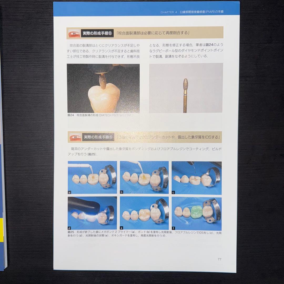 オーバーレイ修復超入門