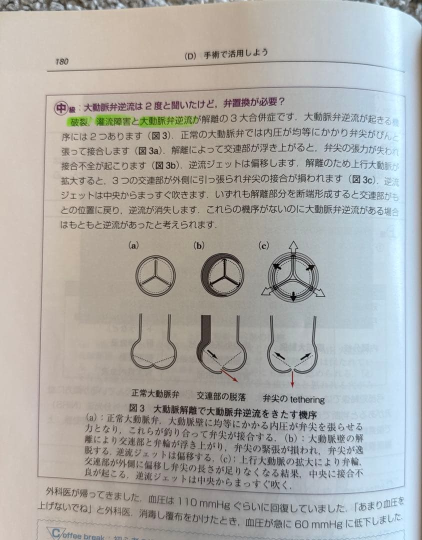 【未裁断】初心者から研修医のための経食道心エコー　2冊セット