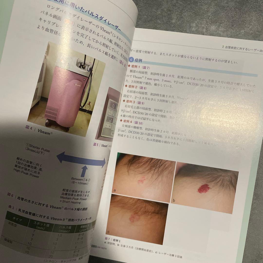 Toto様 ステップアップ皮膚レーザー エキスパートのアプローチ