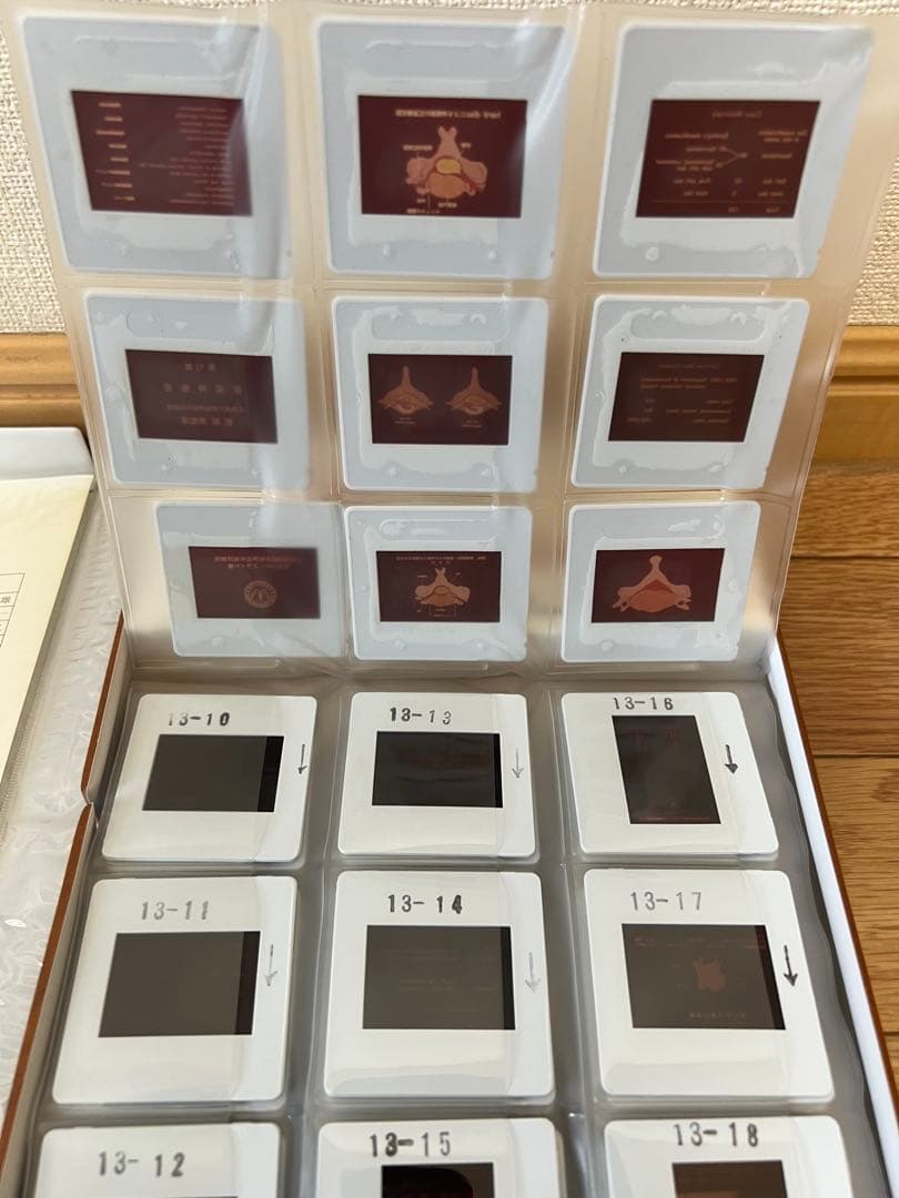 日本脳神経外科学会卒後研修用 第13巻 頸部脊椎症