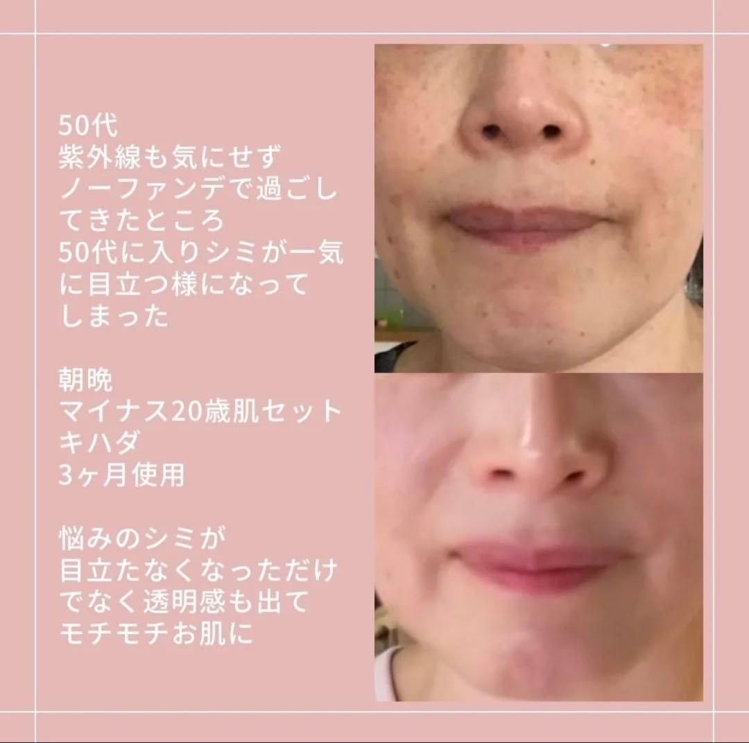 アキノリオ　Newミトコンドリアのちから　ジャー容器　コエンザイム配合　小顔効果