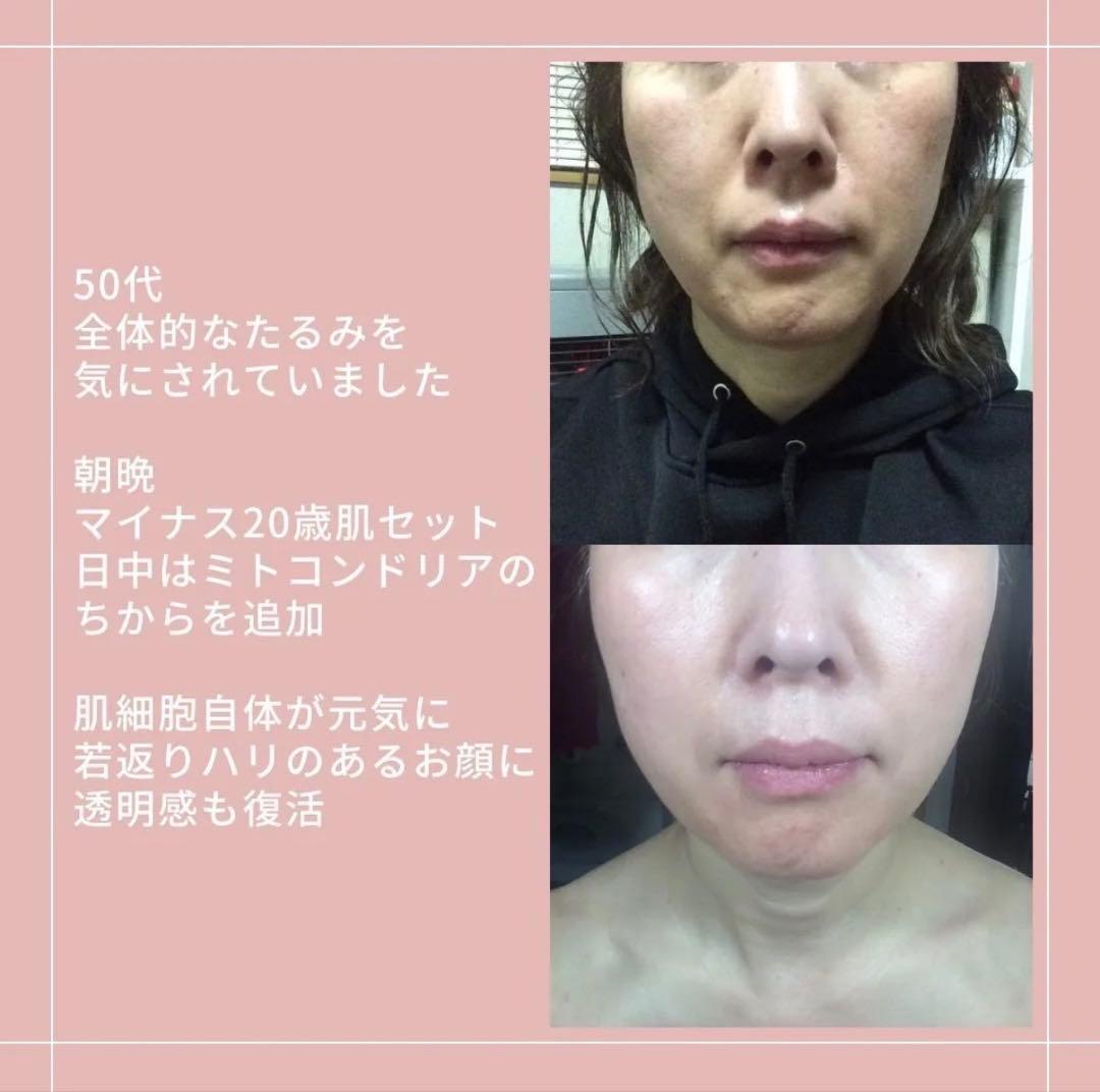 アキノリオ　Newミトコンドリアのちから　ジャー容器　コエンザイム配合　小顔効果