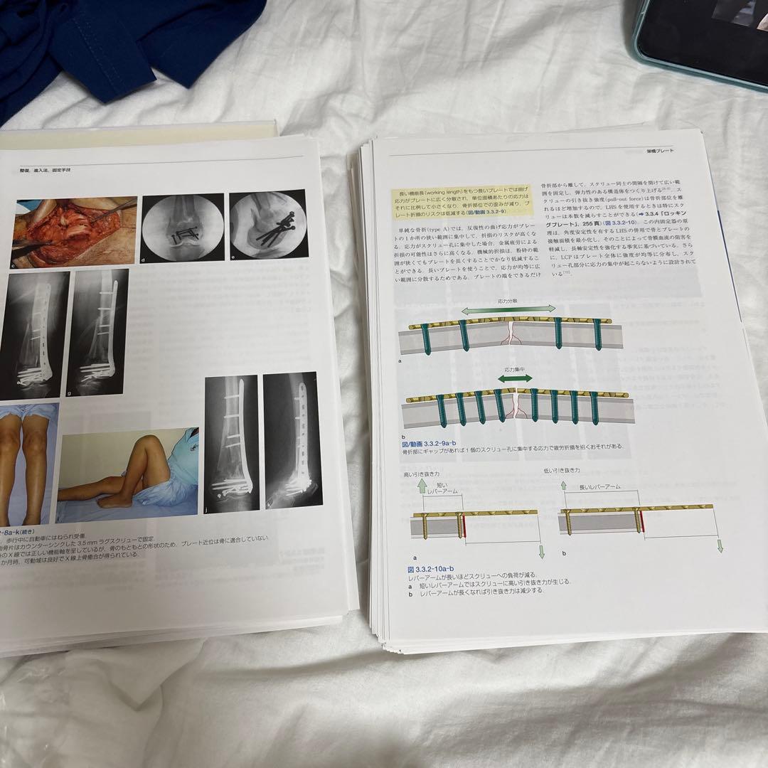 【裁断済み】AO法骨折治療　第3版