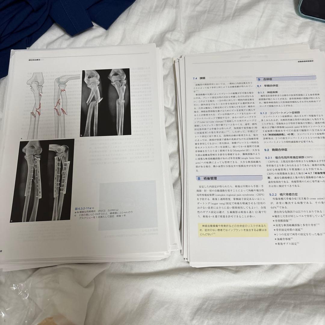 【裁断済み】AO法骨折治療　第3版