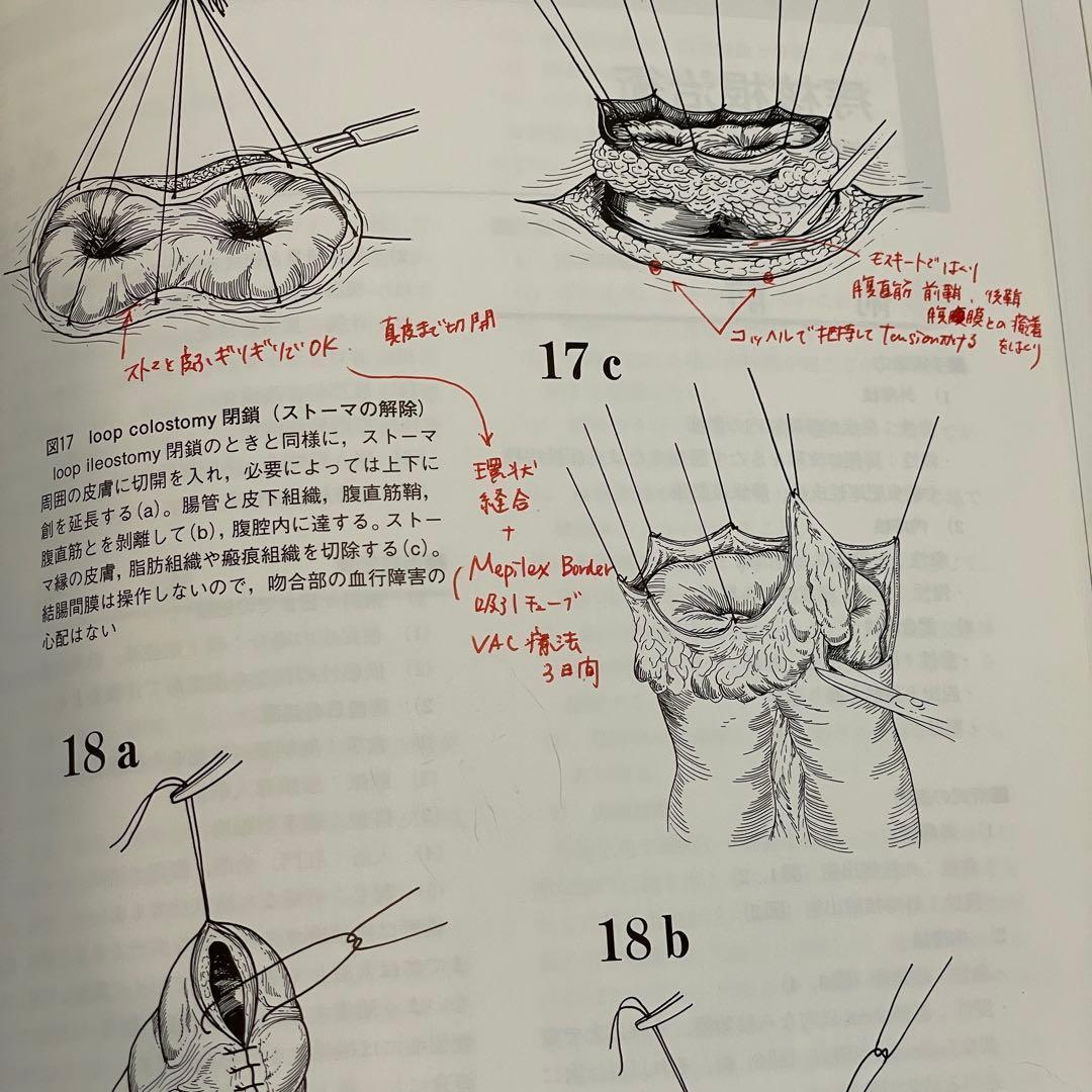 消化器外科　消化器外科専門医であるために必要な標準手術手技アトラス　2002年