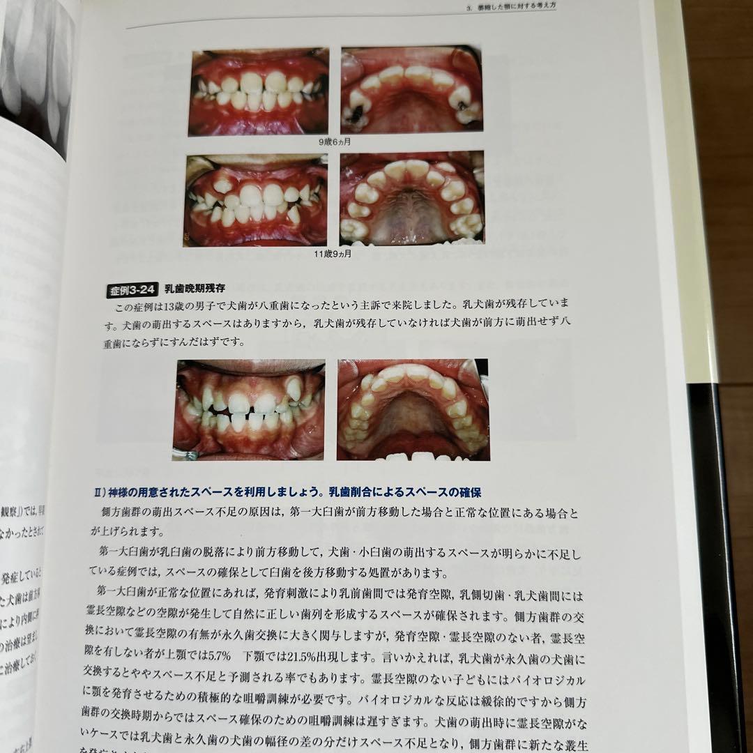 昭和　臨床医のための床矯正・矯正治療 基礎篇　、症例編　２冊セット