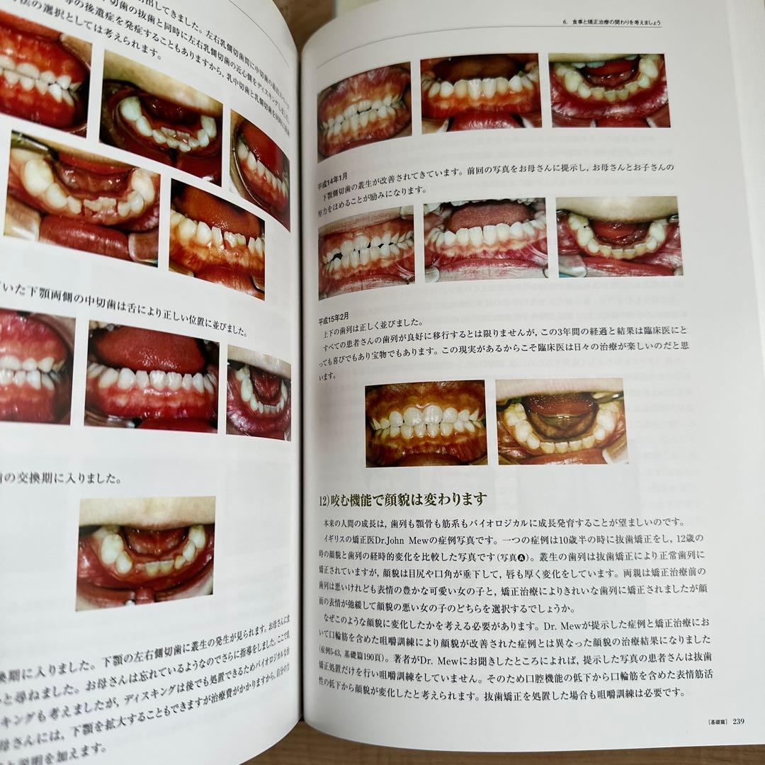 昭和　臨床医のための床矯正・矯正治療 基礎篇　、症例編　２冊セット