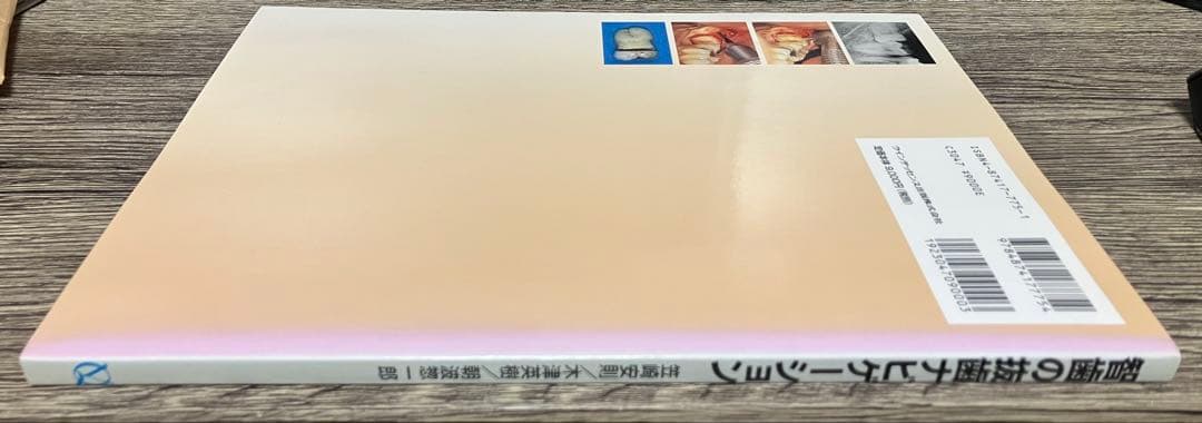 智歯の抜歯ナビゲーション