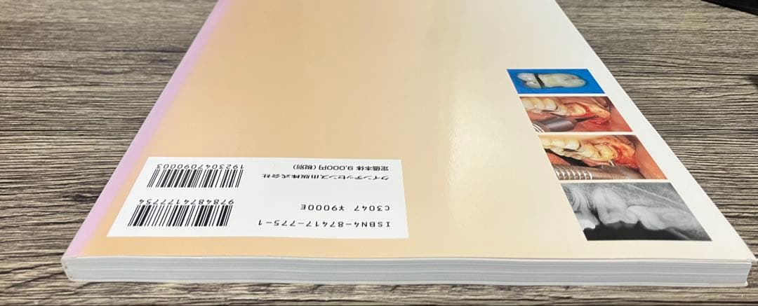 智歯の抜歯ナビゲーション