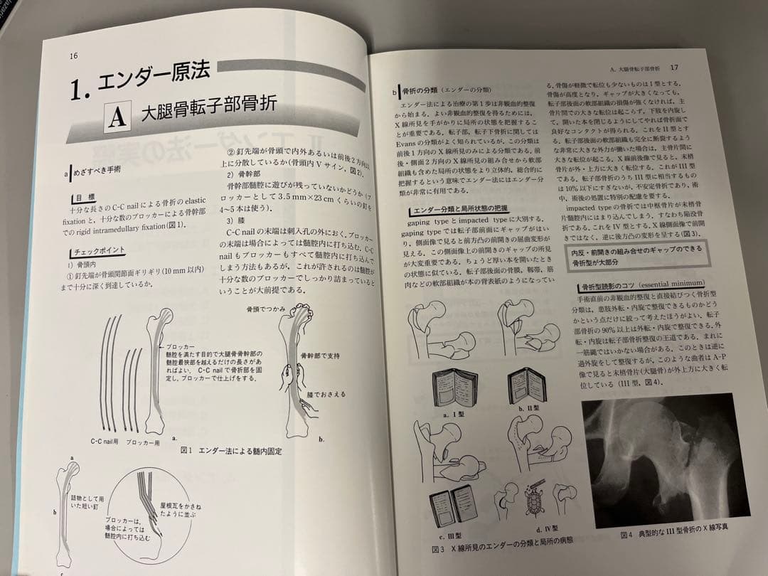 図説エンダー法