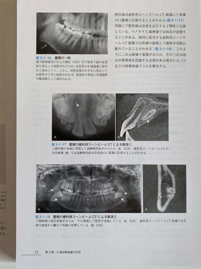 歯科放射線学 第7版【裁断済み】