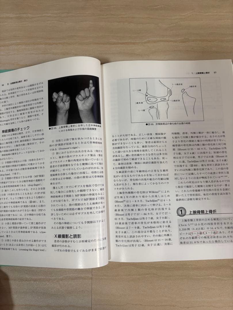 小児四肢骨折 治療の実際 [改訂第2版]（小さな服屋さまご購入予定です）