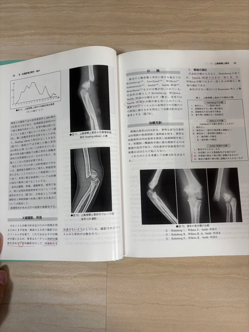 小児四肢骨折 治療の実際 [改訂第2版]（小さな服屋さまご購入予定です）