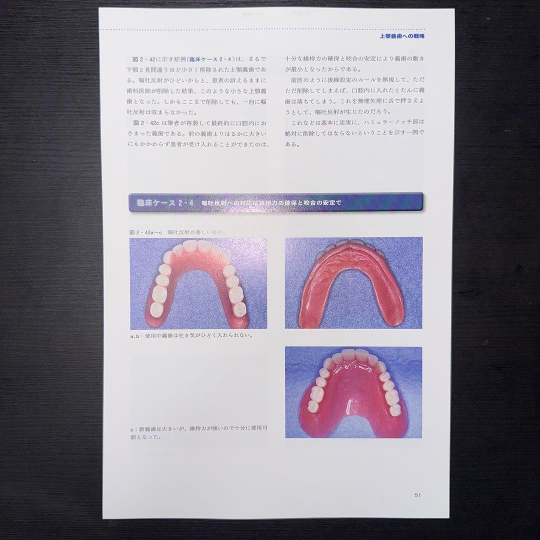 よい義歯だめな義歯