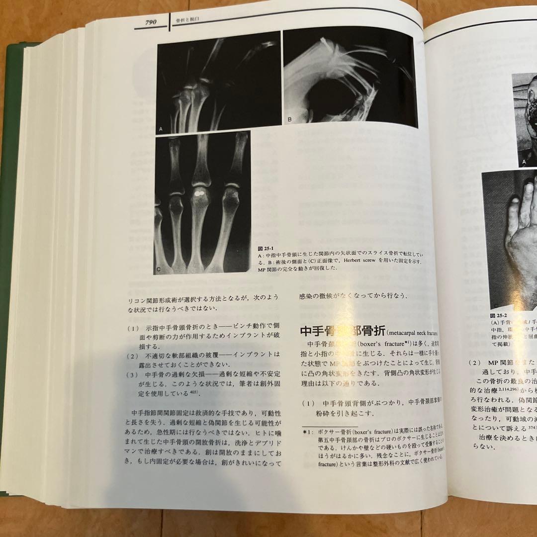 Greenの手の外科手術 日本語版　第4版 Vol. 1, 2