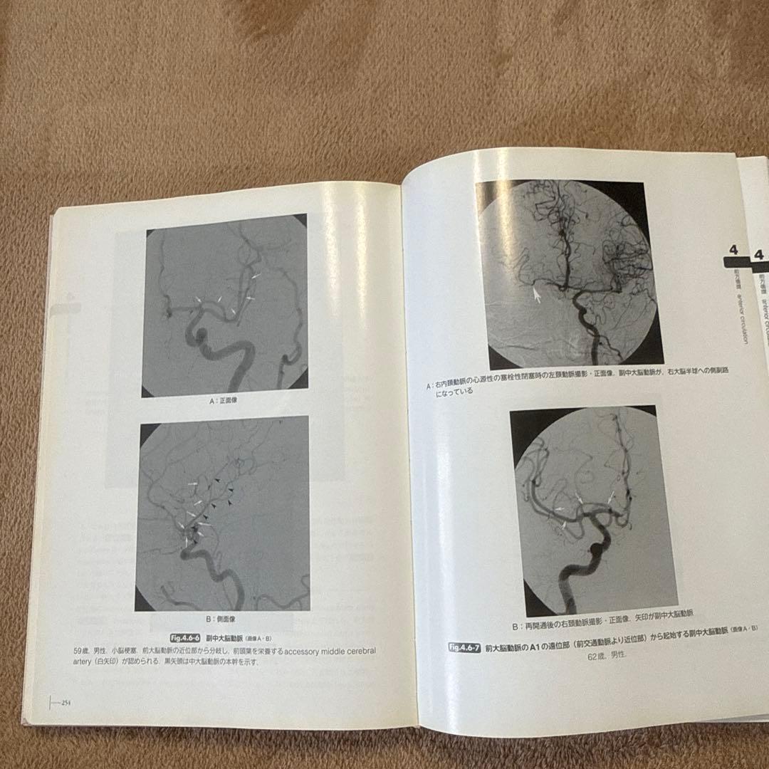 医学書　脳脊髄血管の機能解剖 増補版