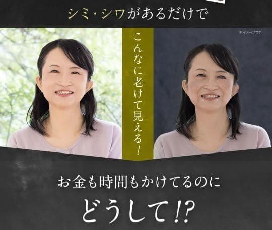 【新品未開封】 キミエリンクルホワイト　2箱