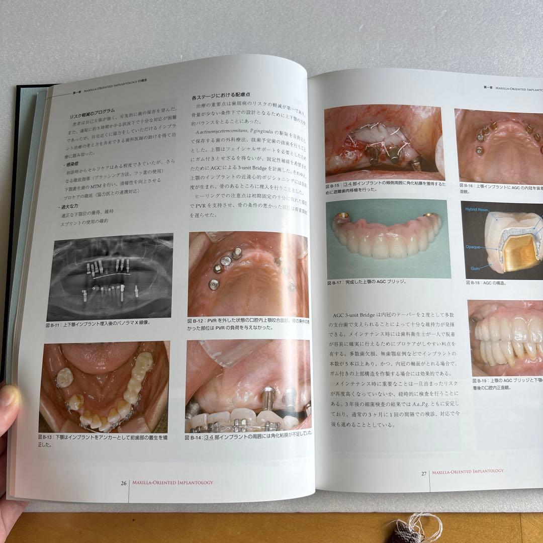 お値下げ相談可能！MAXILLA-ORIENTED IMPLANTOLOGY