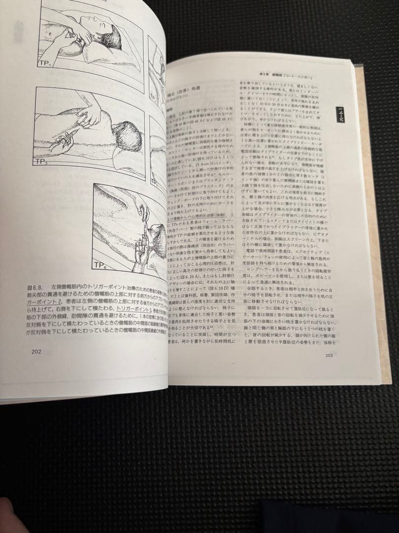 トリガーポイントマニュアル　筋膜痛と機能障害　第一巻　頭頸部編　値上げ予定