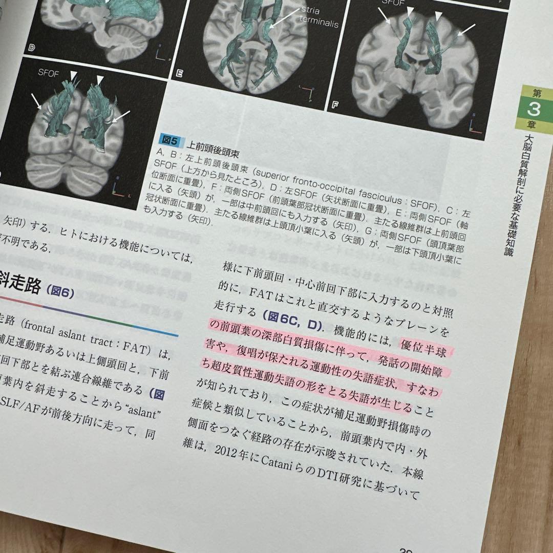 大脳白質解剖入門