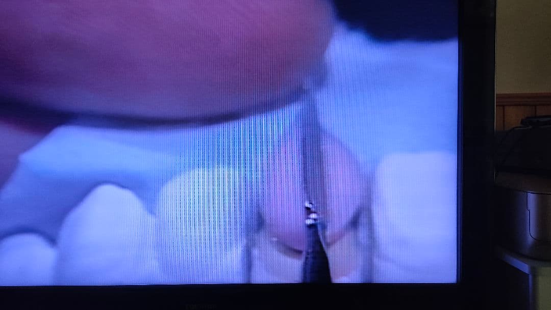 歯科技工　青嶋仁、片岡繁夫、ミューターティース 川崎従道デモビデオ　ポーセレン