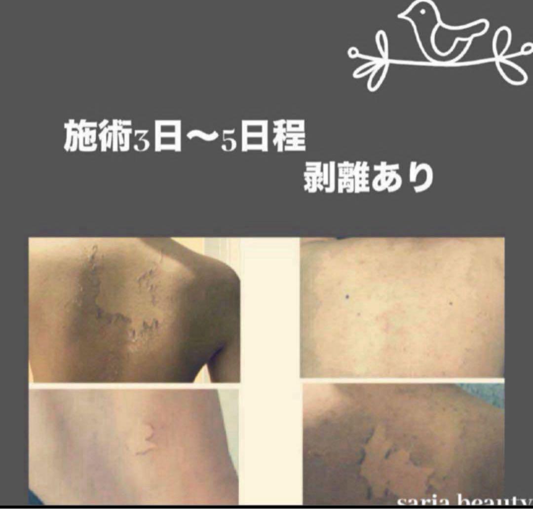 ハーブピーリング　剥離あり　業務用　CICA アロエベラ　和漢　オーガニック