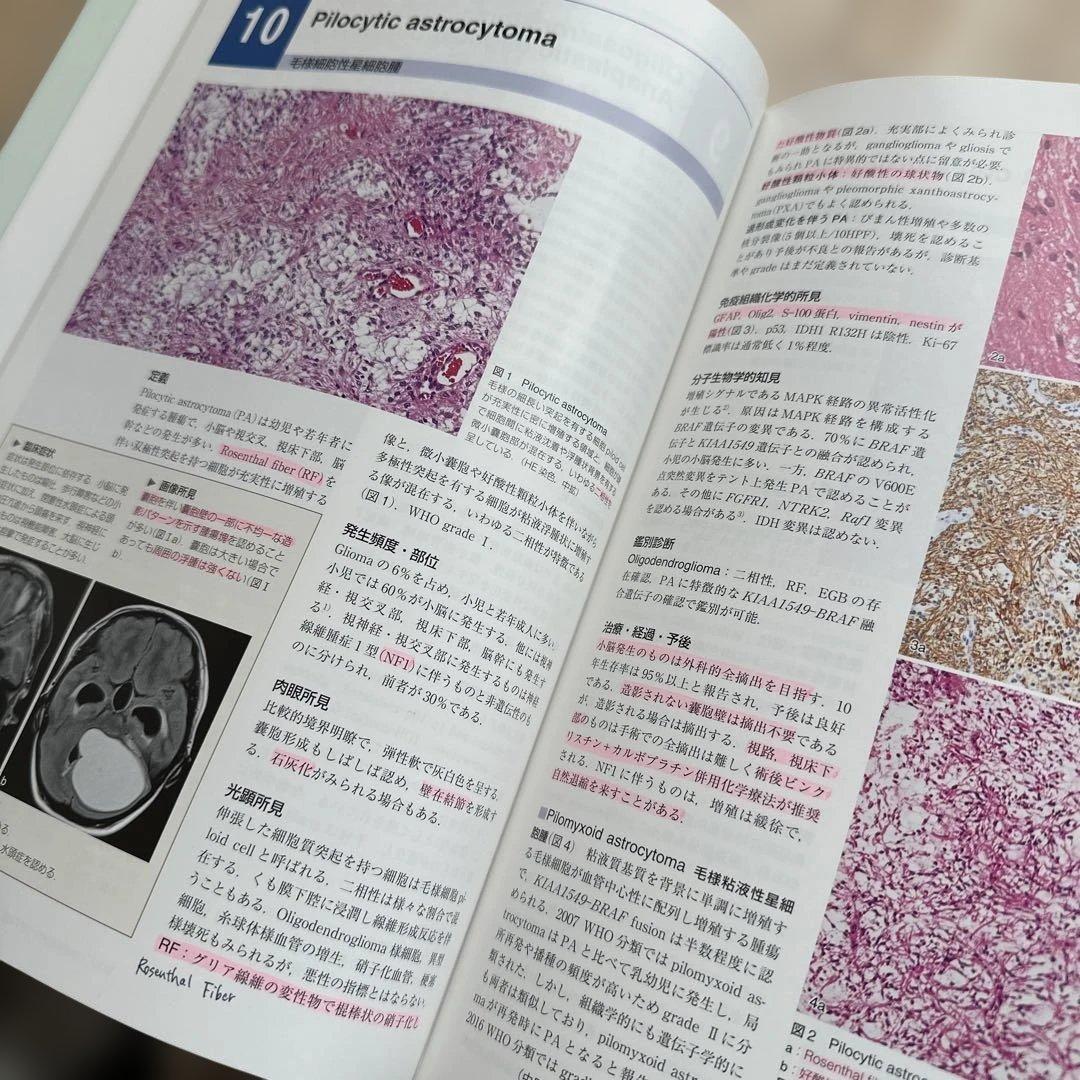 脳腫瘍病理カラーアトラス 第4版