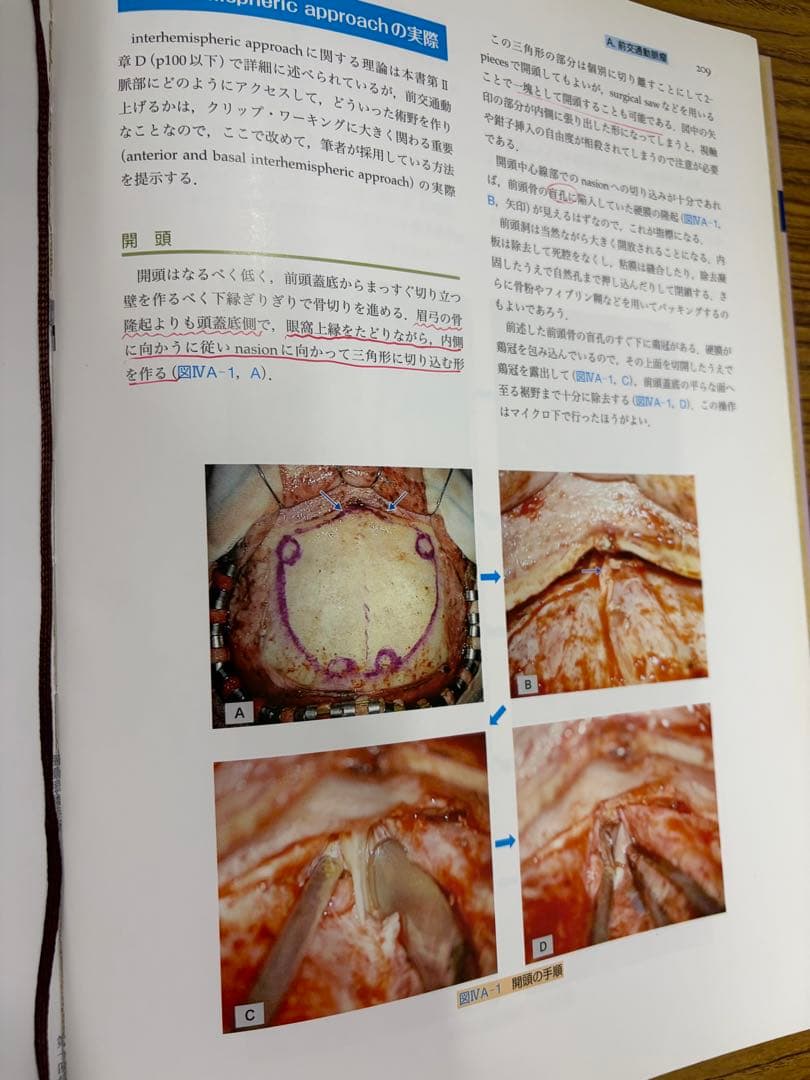 脳動脈瘤手術　基本手術とその応用　上山博康