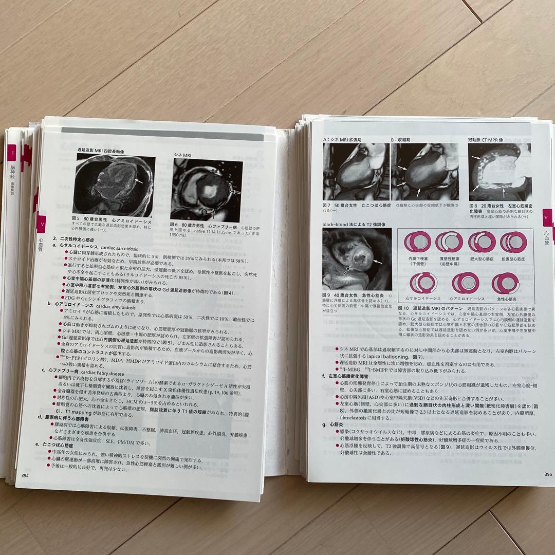 【裁断済み】画像診断パワフルガイド 第2版