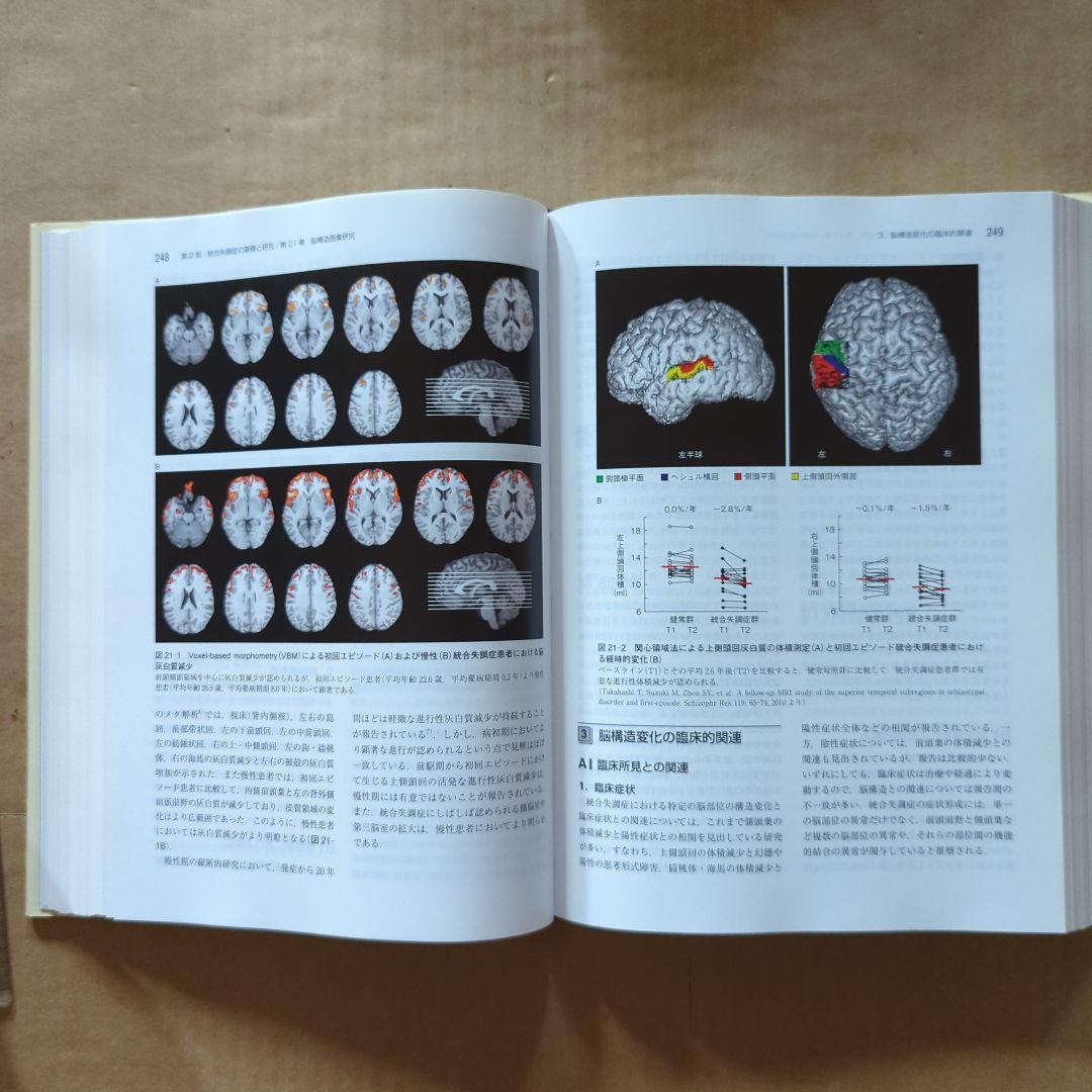 統合失調症 = SCHIZOPHRENIA　精神医学　精神障害　発達障害　事典