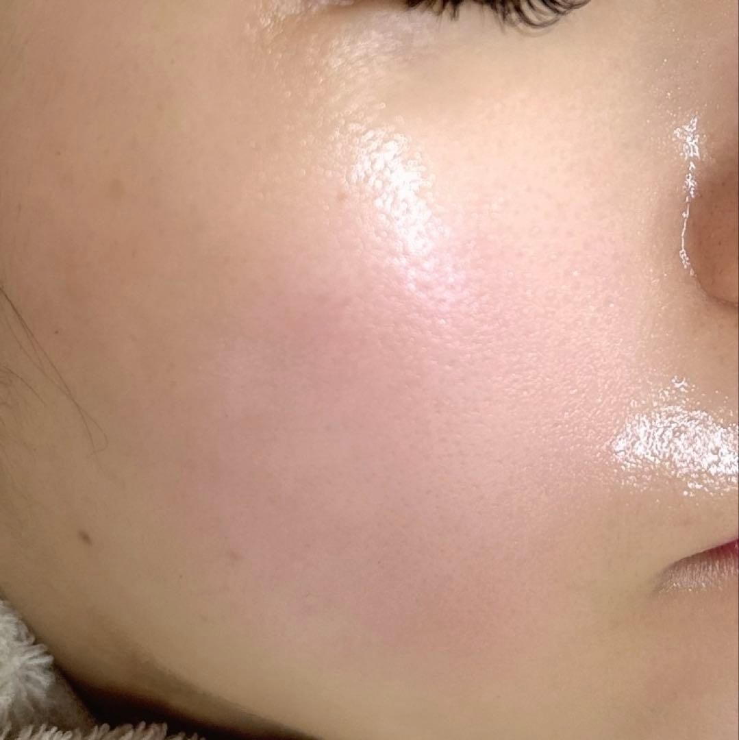 ako.Medisco PeelieveCicaCream 1箱30袋