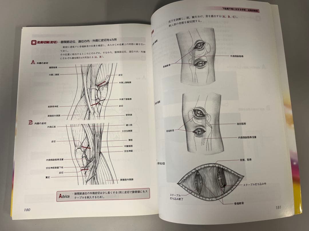 小児整形外科手術テクニック