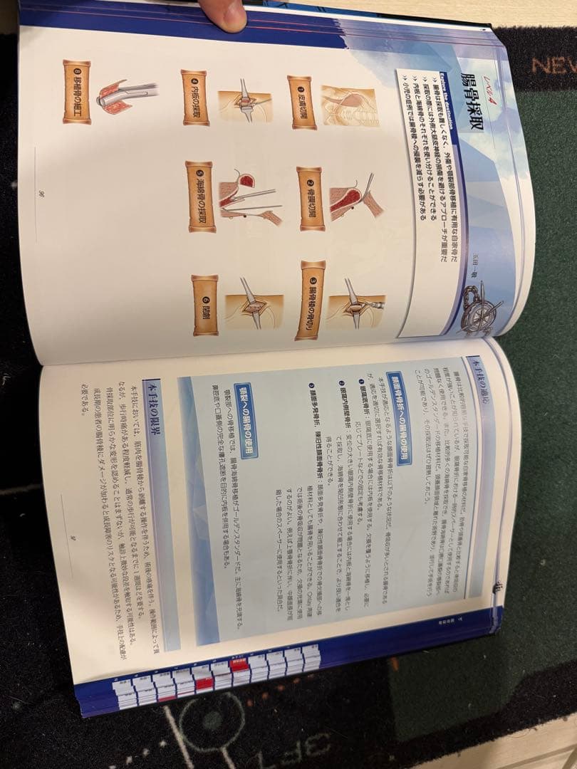 コンパス 顔面骨骨折の治療 基本編