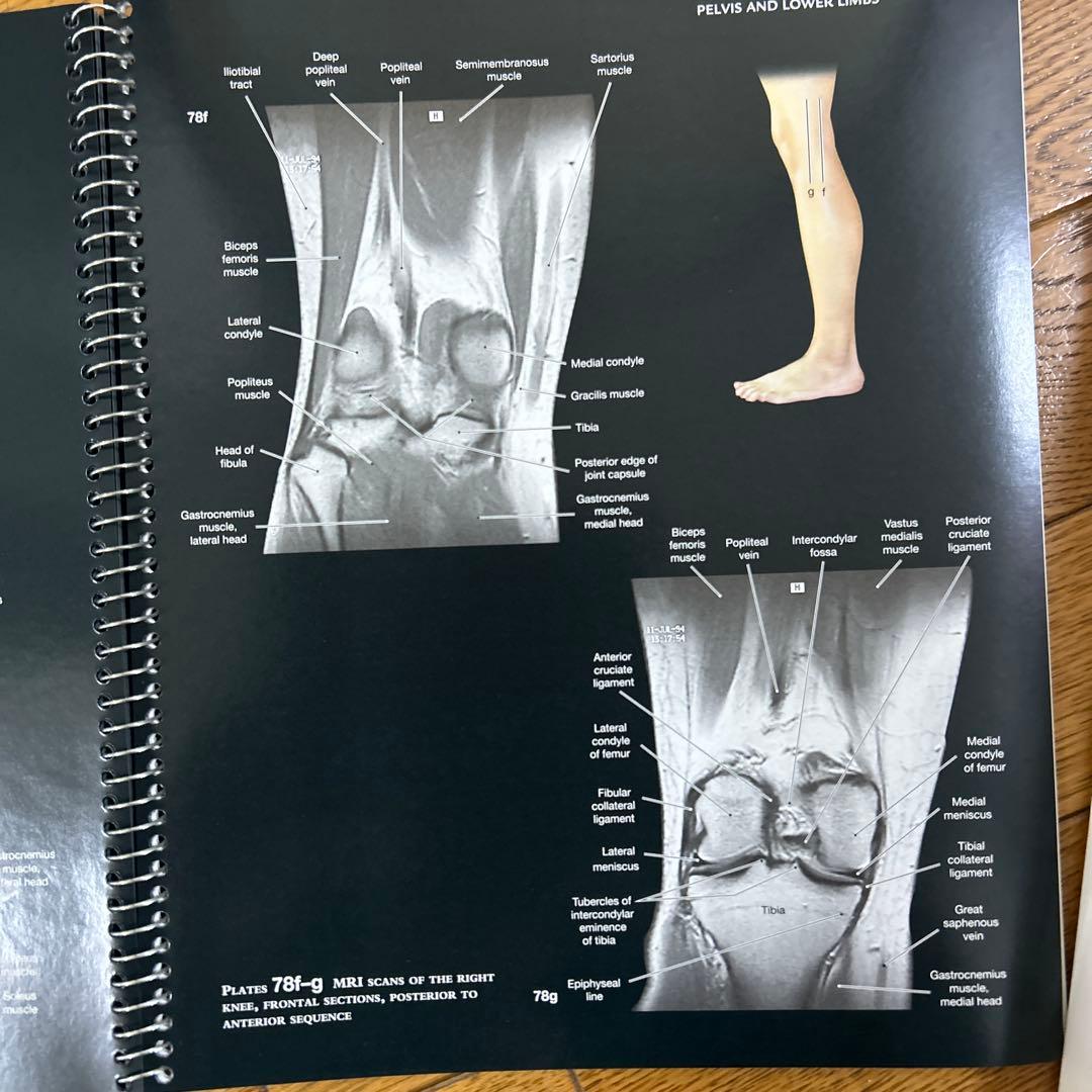 視覚解剖学と生理学、グローバルエディション+マルティーニの人体地図