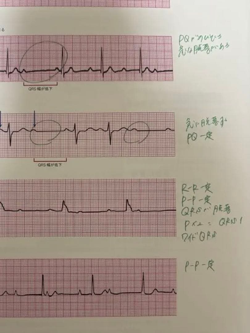 ACLS 二次救命処置/BLS 一次救命処置AHA ガイドライン 2020