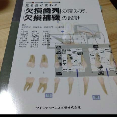 見る目が変わる！欠損歯列の読み方