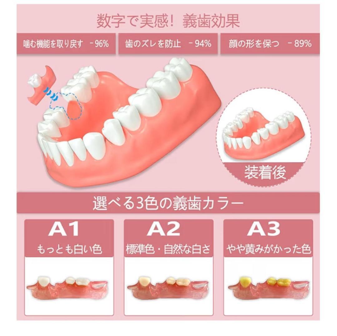 セルフフィッティング 仮歯 歯型採取キット付 カスタマイズ 1本 欠損カバー