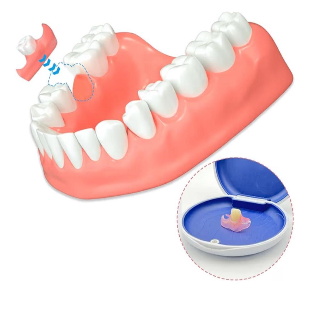 セルフフィッティング 仮歯 歯型採取キット付 カスタマイズ 1本 欠損カバー