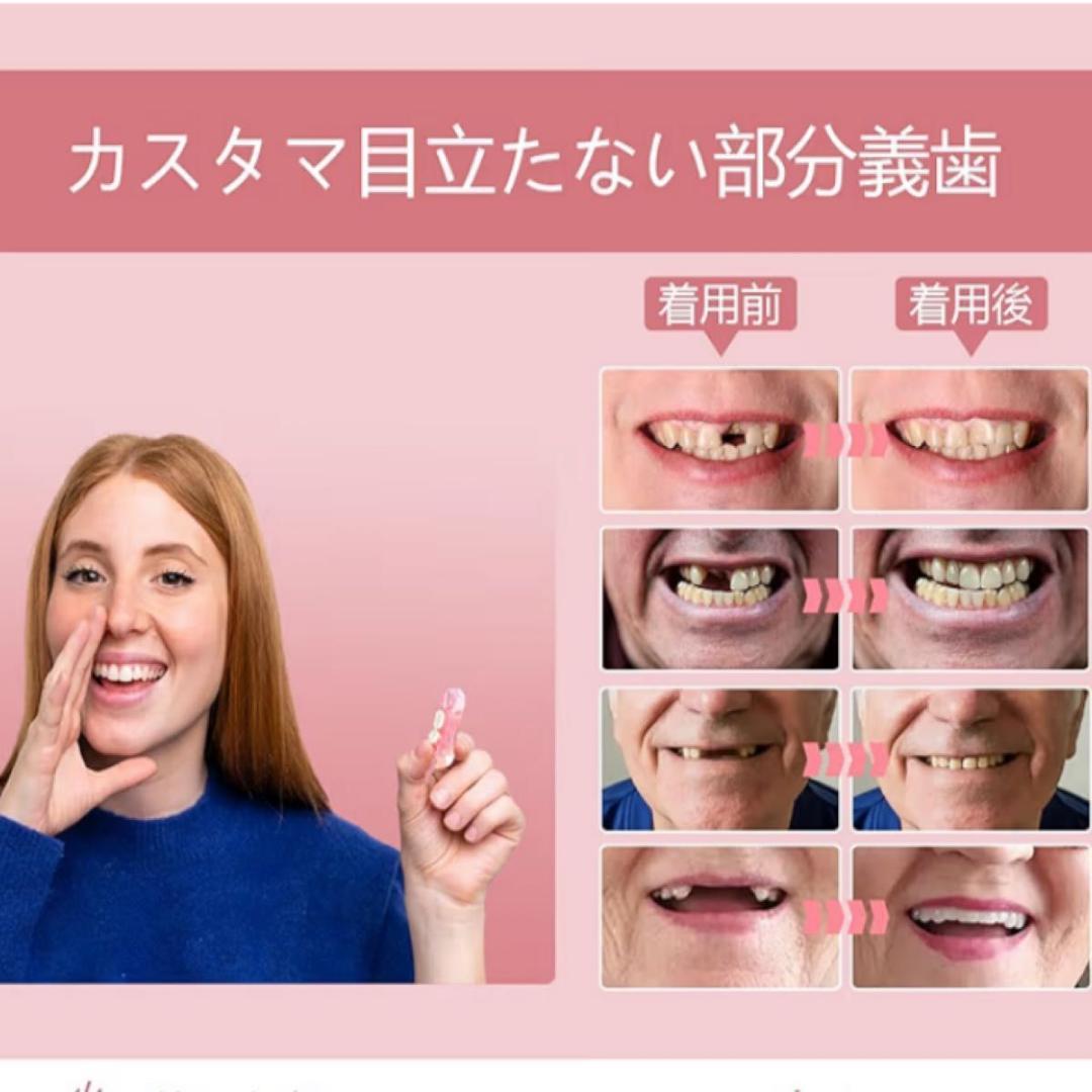 セルフフィッティング 仮歯 歯型採取キット付 カスタマイズ 1本 欠損カバー