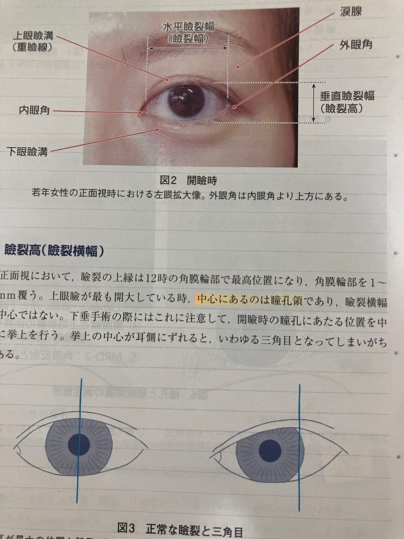 (裁断済み)眼瞼手術チャレンジノート