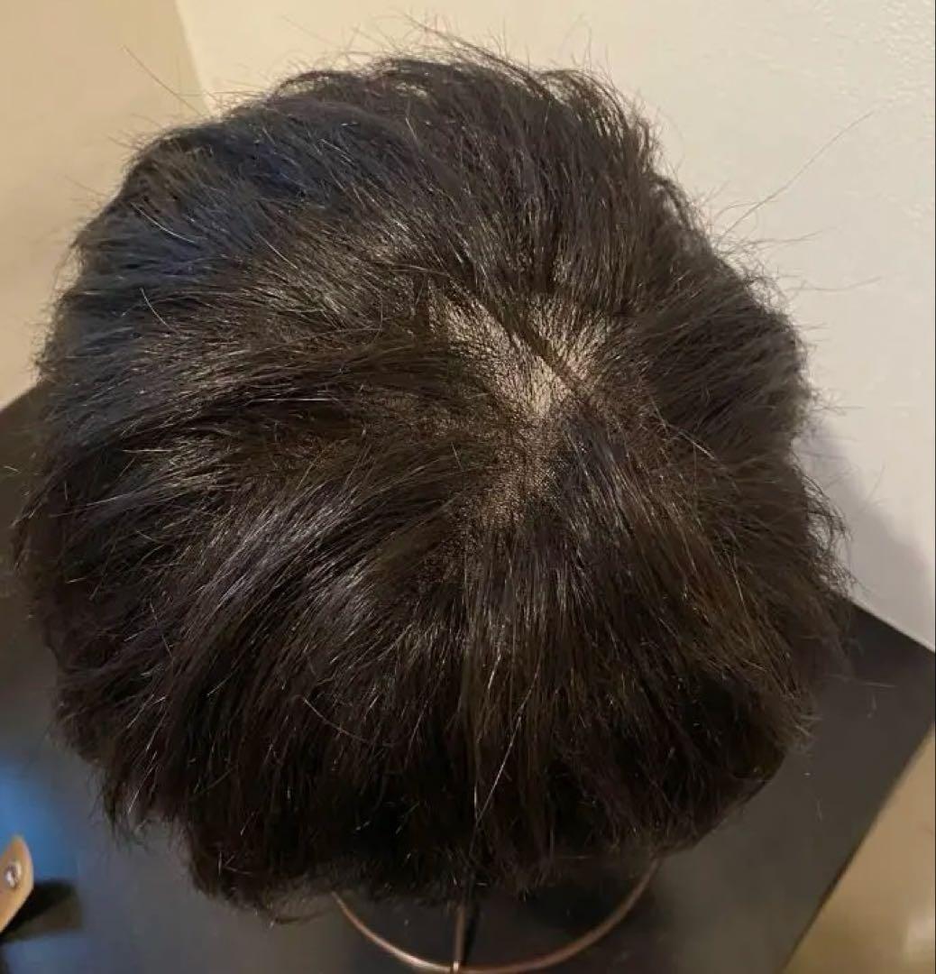 スベンソン医療用ウィッグ人毛　メンズ・レディース&フレッシュヴェール