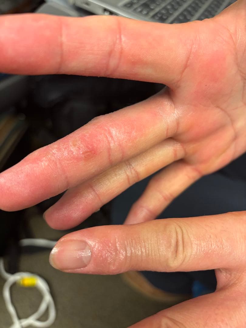 シグナルローション100ml ２本セット