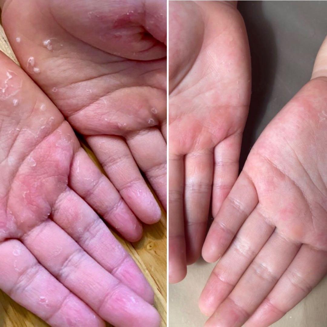 シグナルローション100ml ２本セット