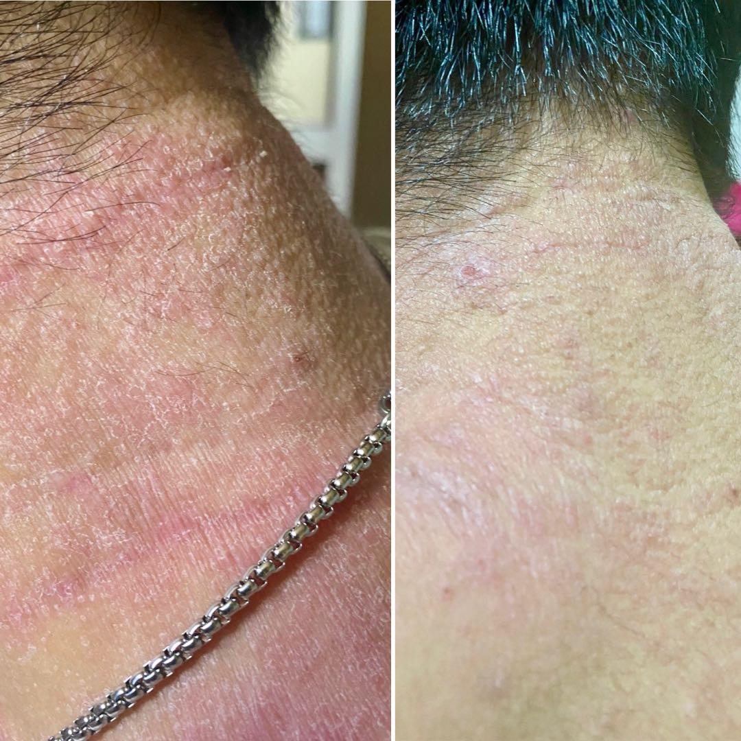 シグナルローション100ml ２本セット