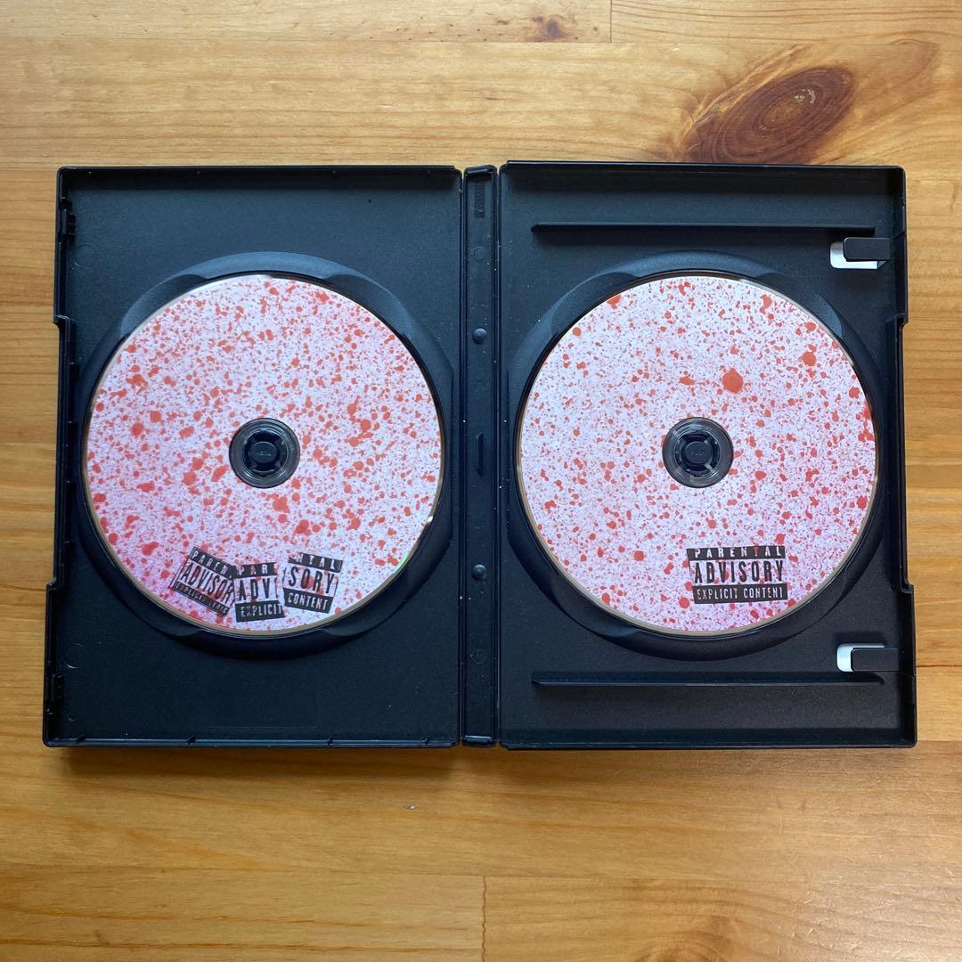 幻覚アレルギーDVD2枚セット　幻覚