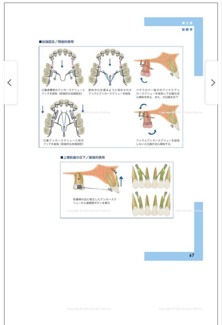 【裁断済み】リンガルブラケット矯正の臨床