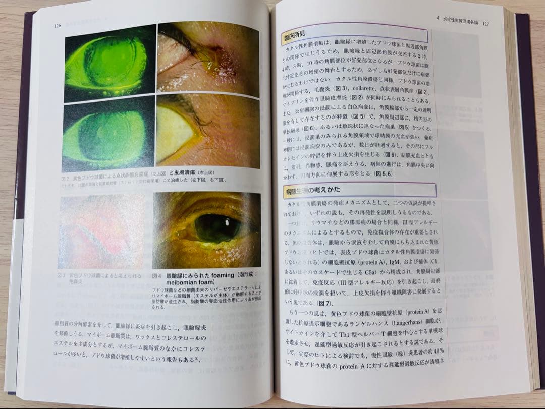 【書き込み少】眼科診療クオリファイ 25 角膜混濁のすべて